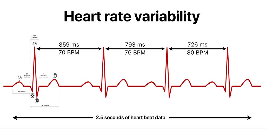 Heart Rate Variability